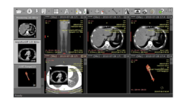 RadiAnt DICOM Viewer