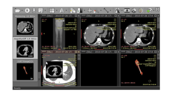 RadiAnt DICOM Viewer